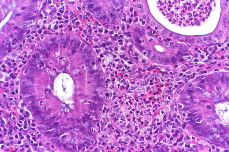 cells