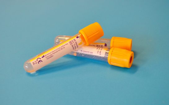 Image of test tubes